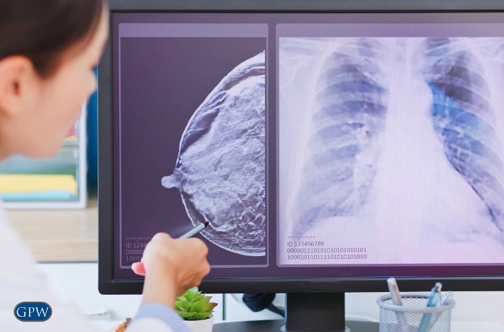 High- Risk Individuals May Consider Mesothelioma Screening for Early Detection