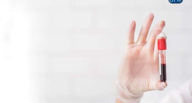 Revolutionizing Mesothelioma Detection: Mayo Clinic’s New Blood Test