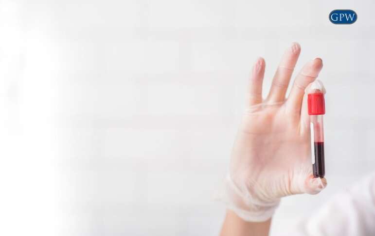 Revolutionizing Mesothelioma Detection: Mayo Clinic’s New Blood Test